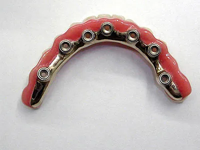 Centro Dental Correa protesis