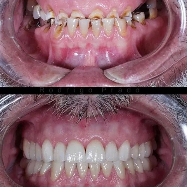 Centro Dental Correa casos pacientes