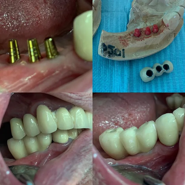 Centro Dental Correa casos pacientes