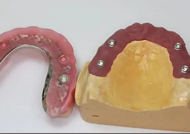 Centro Dental Correa protesis