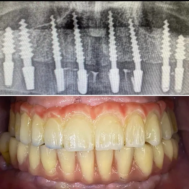 Centro Dental Correa casos pacientes