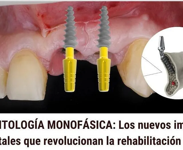 Centro Dental Correa implantologia