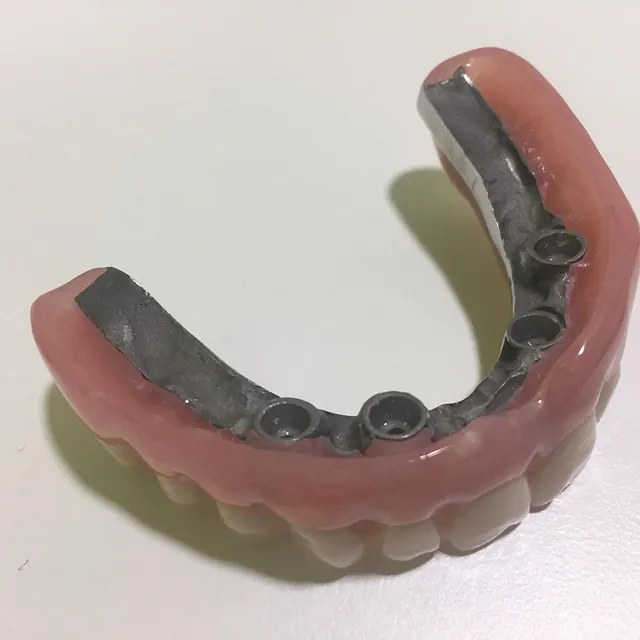 Centro Dental Correa protesis