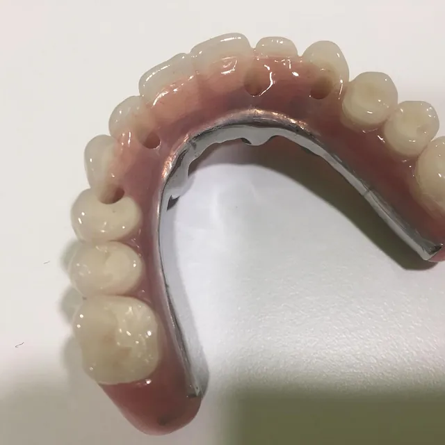Centro Dental Correa protesis