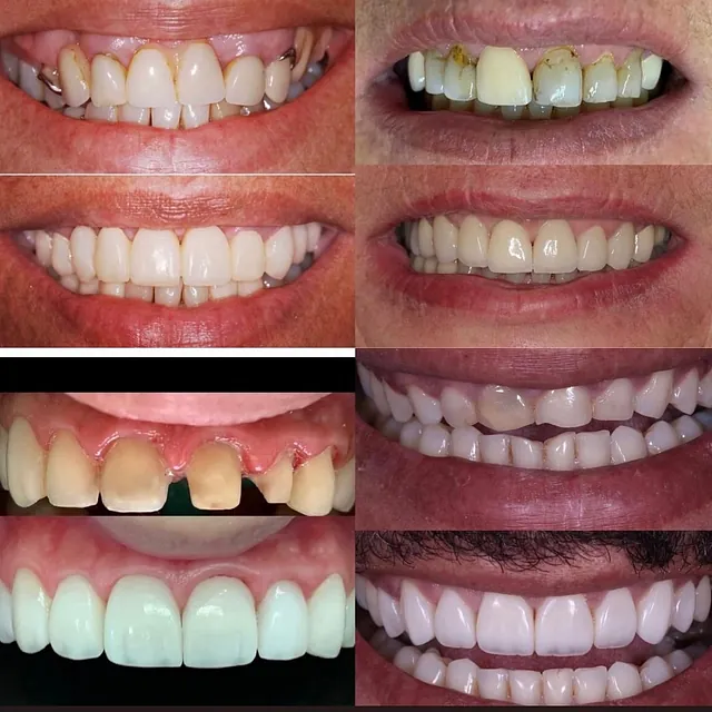 Centro Dental Correa casos pacientes